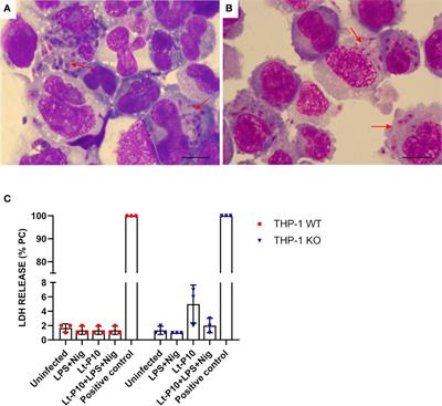 The non-pathogenic protozoon Leishmania tarentolae interferes with the activation of NLRP3 inflammasome in human cells: new perspectives in the control of inflammation